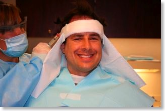 Mike getting preppred for Bosley hair transplant procedure.